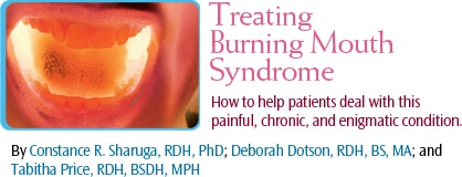 Burning mouth syndrome что это