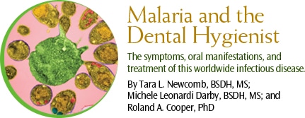 Malaria and the Dental Hygienist - Dimensions of Dental Hygiene | Magazine