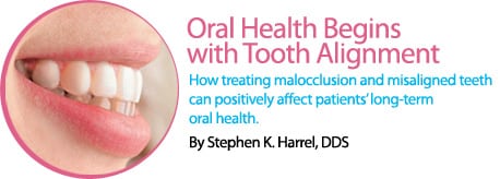 Oral Health Begins with Tooth Alignment - Dimensions of Dental Hygiene