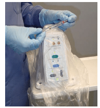 Local Anesthesia Delivery System