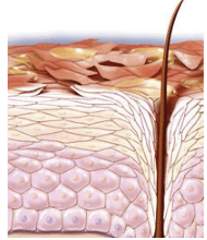 Hand Dermatitis