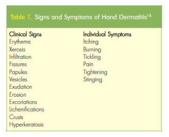 Signs of Hand Dermatitis