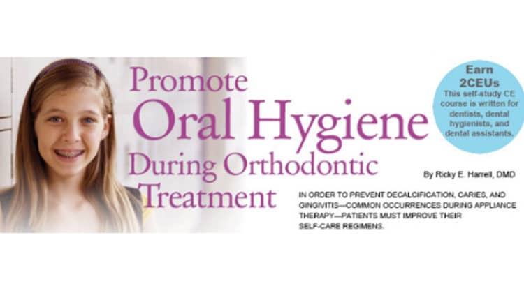 Promote Oral Hygiene During Orthodontic Treatment