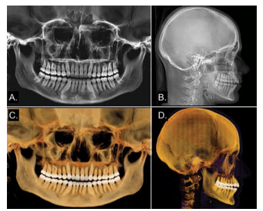 CBCT Orthodontics Scan