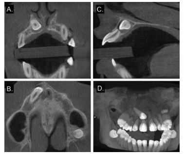 CBCT Orthodontics Scan