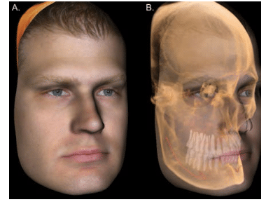 3D Orthodontics Scan