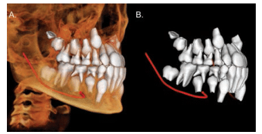 CBCT for Orthodontics 