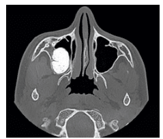 Diagnostic Radiography