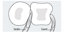 Instrumentation for Anterior Dentition