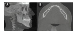 CBCT Image