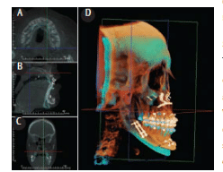 CBCT Screenschot