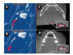 Lateral CBCT