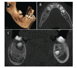 CBCT Rendering