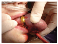 Example of Tongue Trauma