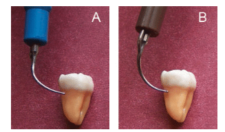 Ultrasonic Insert/Tip Technique