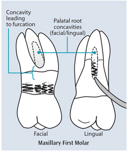 Ultrasonic Working Stroke