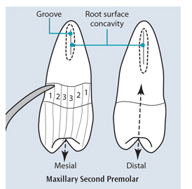 Ultrasonic Working Stroke