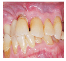 Industry Info Story on Periodontal Health