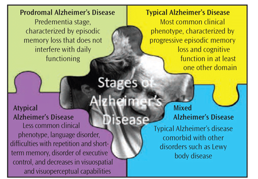 Alzheimer's disease progression