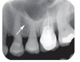 Tooth Anamolies Noted