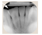 Tooth Anomalies