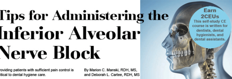 Inferior alveolar nerve, Radiology Reference Article