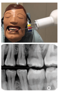 Prevent Technique Errors - Dimensions of Dental Hygiene