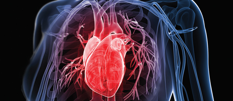 Managing Patients With Critical Cardiac Conditions course image