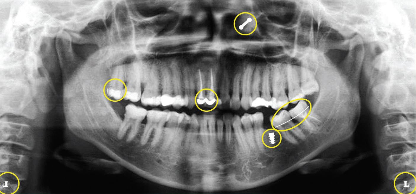 The Art of Dental Radiography - Dimensions of Dental Hygiene
