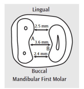 Mandibular First Molar