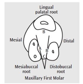 First Molar Internal Concavities