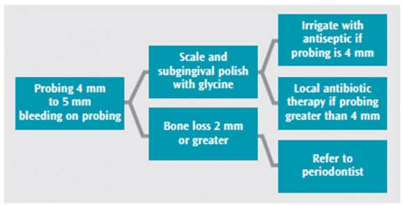 Dental Implants Probing