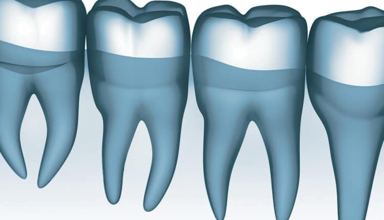 Mean scores for dental caries in the mandibu- lar molars of each group.