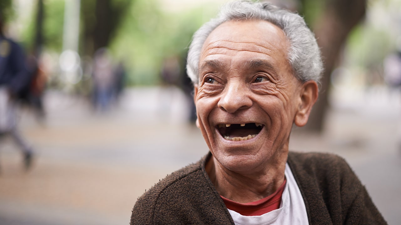 Smiling man with missing teeth