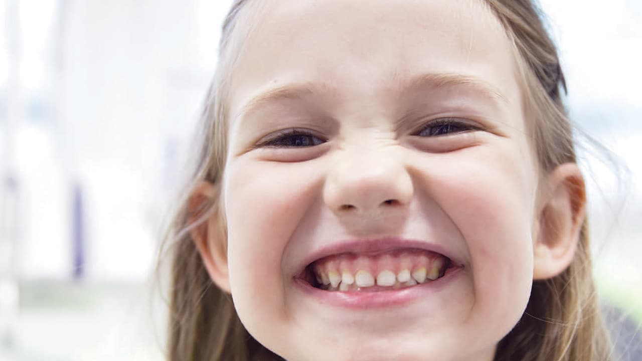 Child displaying primary dentition