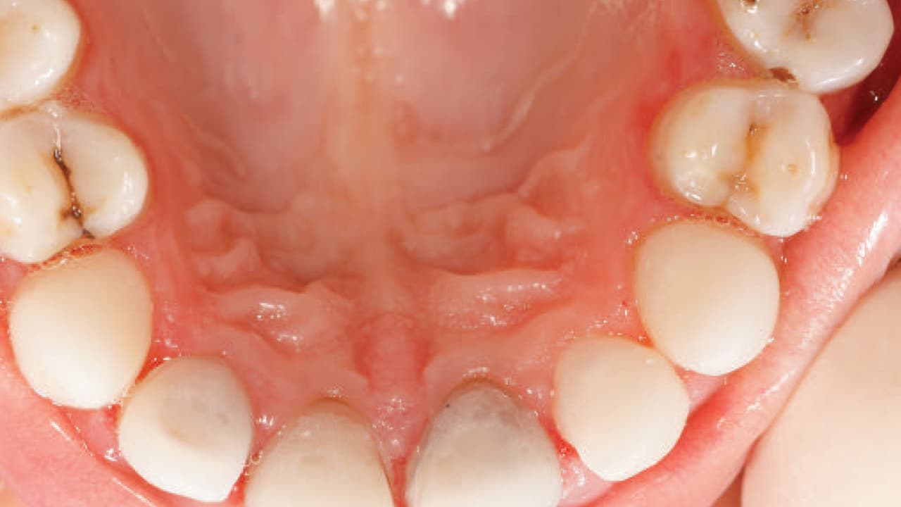 Oral cavity