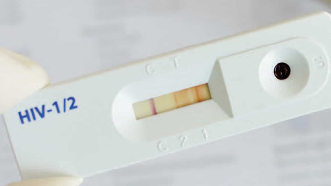 HIV testing in dental office