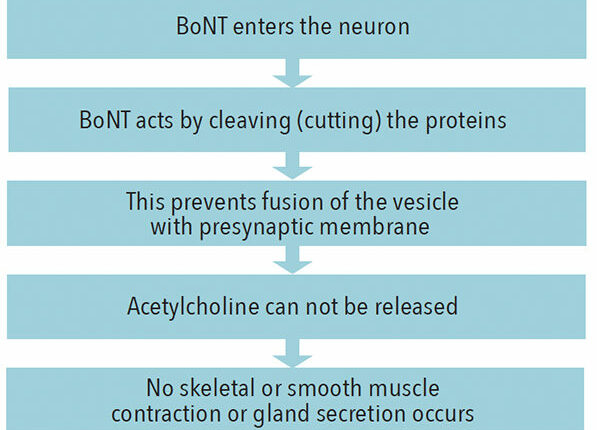 botox-figue-1