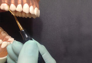 Instrumenting first molar teeth