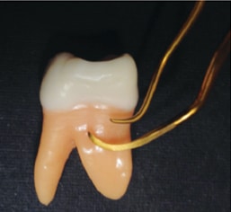 Maxillary first molar.