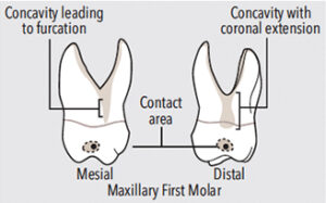 Maxillary first molars