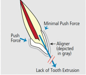 Tooth shape