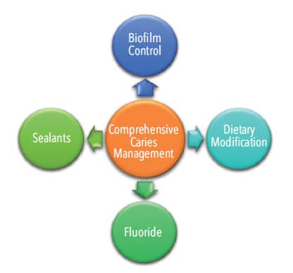 Sealants as part of caries management