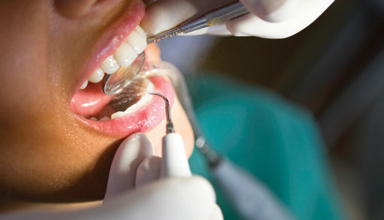 periodontal maintenance