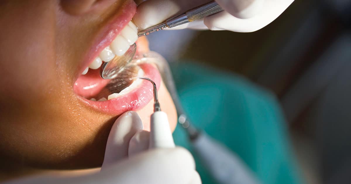 Woman undergoing periodontal maintenance