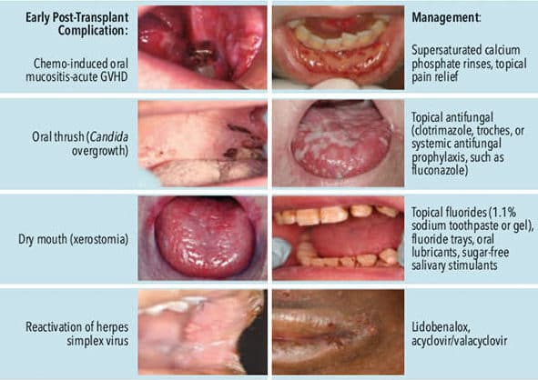 stem-cells-fig-1 - Dimensions of Dental Hygiene | Magazine