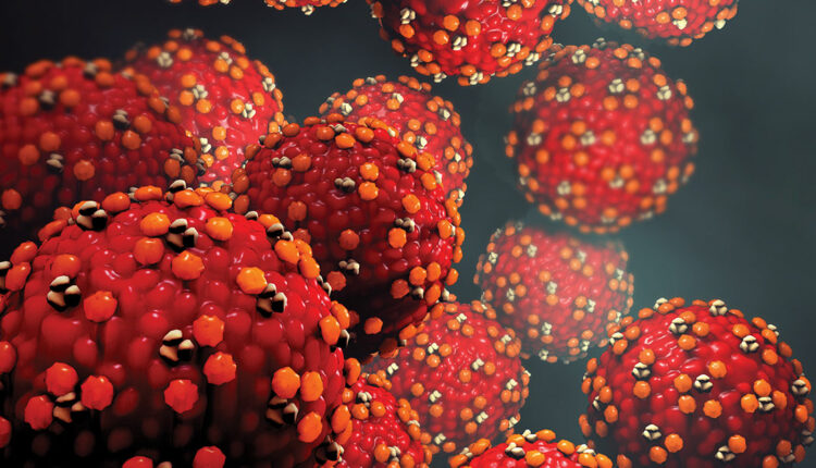 Measles