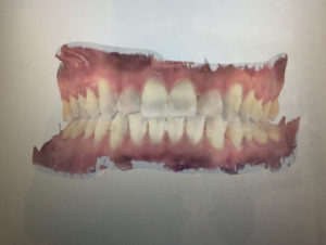 Full color intraoral scan.