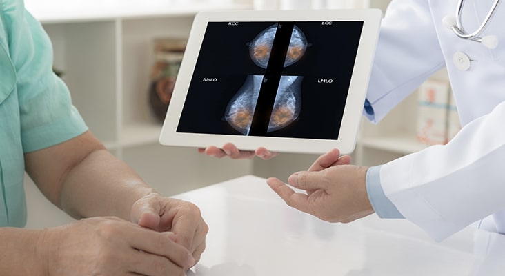 breast cancer breaststroke concept. doctor explain mammogram results of breast test from x-ray scan on digital tablet screen to patient.