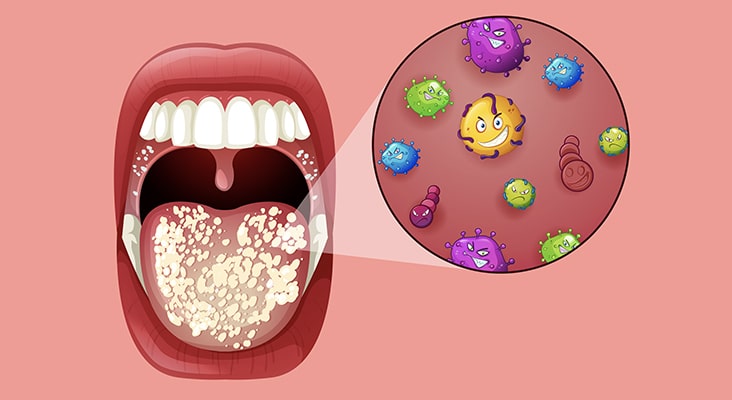 Risk of Ultrasonic Aerosols - Dimensions of Dental Hygiene | Magazine